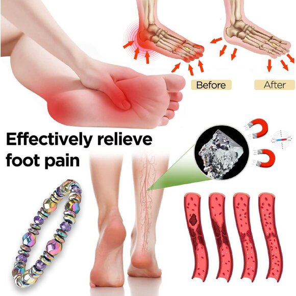 Multicolor Adjustable Hematite Bracelet - Stylish Relief for Arthritis & Anxiety - Picture 3 of 9